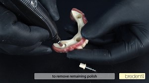 Working with bredent products 🦷🛠️ Tutorial: Friction adjustment and polishing of BioHPP secondary constructions Plaque-resistant, controllable and scientifically proven! #bredent #bredentgroup #dental #dentalindustry #dentaltechnician #dentaltechnology #dentures #frictionadjustment #gingiva #laboratory #oralhealth #prosthetics #secondaryconstruction #smile #teeth #togetherforabetterlife #wearebredent #weareone | bredent group International