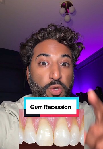 Understanding Gum Recession: Causes and Solutions