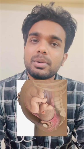 Expected delivery date 👩🏻‍🍼#delivery #medico #information #trending #viral