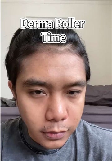 Derma Roller for Hair Growth: My Weekly Routine