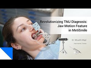 Revolutionizing TMJ Diagnosis: Jaw Motion Feature in MetiSmile | Dr. Mouelhi Majd