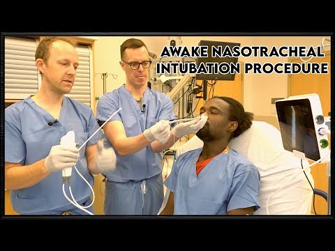 Awake Intubation Nasal Approach
