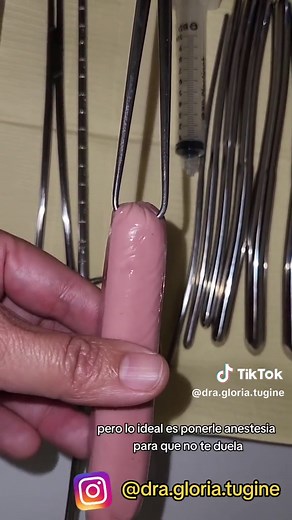 Colocación del DIU: Proceso y Consejos Esenciales