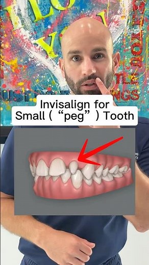Can Invisalign Fix One Front Tooth That Is Smaller Than the Other (“Peg Laterals”)?