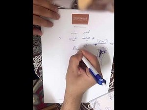 Gamma nail in trochentric fracture