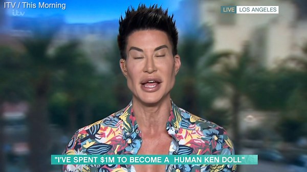 Justin Jedlica says he uses plastic surgery as an expression of his 'creativity'