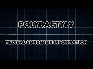 Polydactyly (Medical Condition)