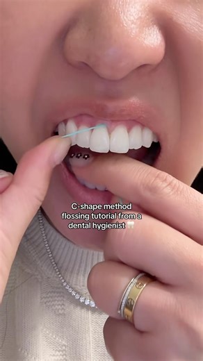 Tiffany S. Kim on Instagram: "Not you guys seeing my dinner! 😅 A lot of you are asking if it’s safe to go that deep when you’re flossing, and the answer is YES! If you don’t go deep enough, you’re not effectively removing the plaque and debris, which can lead to bone loss, AKA periodontal disease! Hope this is helpful. ❤️ #flossing #tutorial #fyp #dentalhygienist #oralhealth #oralhygiene #gumdisease #teethtok #dentistry @meetcocolab"