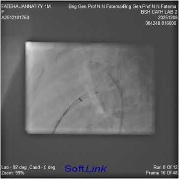 Fateha Jannat 7 Y 1 M 17 Kg PDA device closure