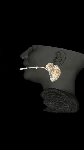 CT SIALOGRAM #anatomy #mri #brain #radiology #ctscan