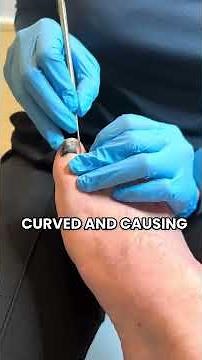 Toenail Trauma Explained