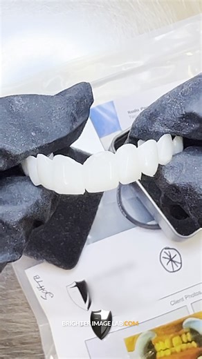 Everyday we hand contour our veneers with absolute precise detail for the best quality product we can possibly create! Learn More here: https://brighterimagelab.com/financing-veneers-with-brighter-image-lab/ #smiledesign #beforeafter #bilveneers #brighterimagelab #veneers #newteeth #financing #perfectsmile #smilemakeover | Press On Veneers by Brighter Image Lab
