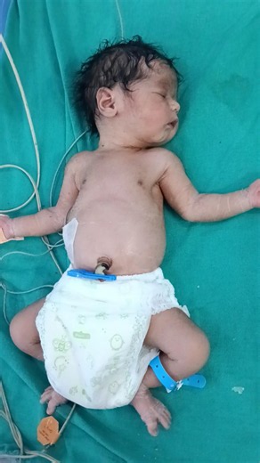 baby sleeping 😴 #cutebaby #cutebaby #babychoice #baby #babyshower #justborn #newborn #newbornbaby