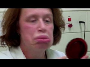 Swollen Lips - Bizarre ER