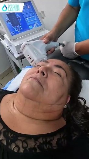 HIFU 4D antiage con el Dr. Max Tafur Horna, desde Lima, Perú