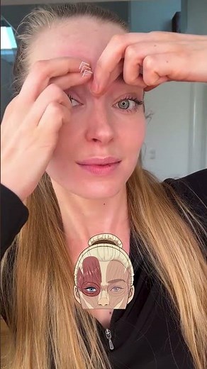 Smooth Forehead without Botox