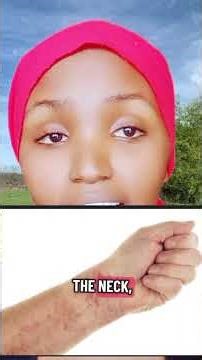 THE EXACT CAUSE OF LEUKEMIA #leukemiaawareness