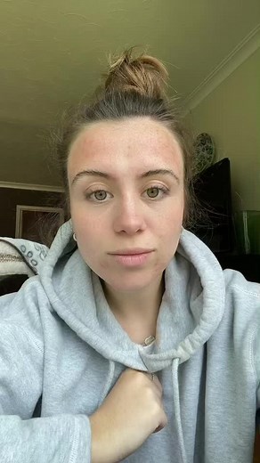 Buy Plan B Pill in Canada - Your Options Explained