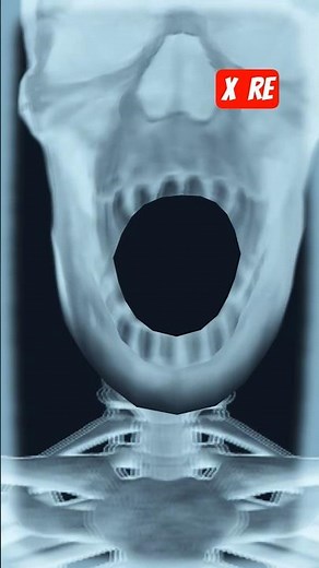 Why Manga and Anime Are Obsessed with X-Ray Vision