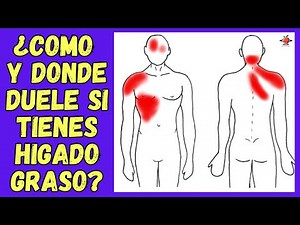 🆘 HOW AND WHERE DOES FATTY LIVER HURT? AND OTHER SYMPTOMS THAT ACCOMPANY FATTY LIVER PAIN 🆘