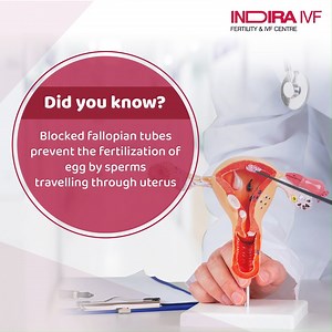Learn about blocked fallopian tubes and how an HSG test can identify them, crucial for planning effective fertility treatments. Take the first step towards understanding your fertility. Call for a free consultation with our experts at Indira IVF today: 18003094405 #IndiraIVF #UnexplainedInfertility #IVFTreatment #ICSIProcedure #FertilitySolutions #HopeForParenthood #FertilityTreatment #ParenthoodDreams #CompleteYourFamily #FreeConsultation #FertilitySpecialists #InfertilitySupport #IVFSuccess #F
