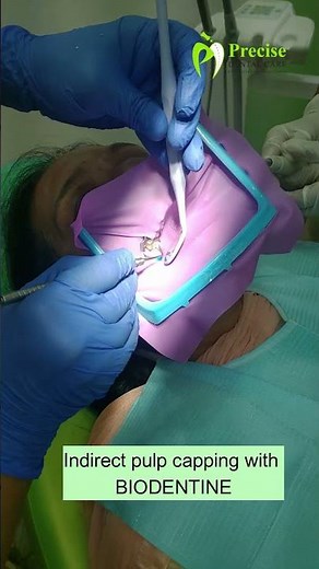 Indirect Pulp Capping #dentistry