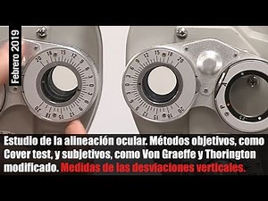 Optometría_3. Estudio de la alineación ocular.