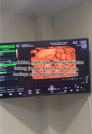 Momen Lucu Gender Reveal: Si Adek Ikut Dengar Kakaknya