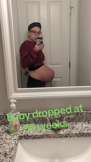 Pregnant Belly Drop: When Does Baby Drop at 35 Weeks?