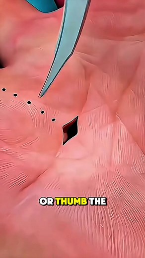 2.9K views · 30 reactions | 4.Ever wondered how Trigger Finger Surgery is done Trigger Finger Release Surgery helps fix a finger that locks are clicks due to a tight tendon sheath. Watch how surgeons carefully release the trappe | Surgery Page | Facebook