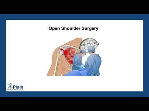 Open Shoulder Surgery