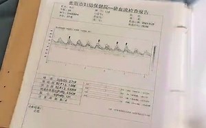 晒晒我的产检单！生个娃太不容易了，整个孕期花我的钱，抽我的血，还让我提心吊胆#孕检报告单 #孕期记录