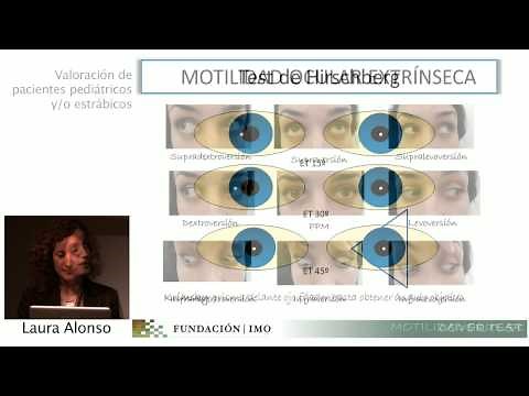 Cover Test y Motilidad Ocular Extrínseca