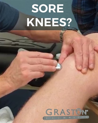 #FunFactFriday 🦵💥 Knee pain slowing you down? Here’s something cool 👉 A recent study found that using Instrument-Assisted Soft Tissue Mobilization (IASTM) on the Iliotibial Band (ITB) helped people with knee osteoarthritis improve their range of motion and reduce pain—in just 2 weeks! 🙌 When paired with exercise, IASTM (like the Graston Technique) can break down scar tissue and improve tissue healing—making everyday movement feel easier and more comfortable. 💬 Tag a friend who needs to hear