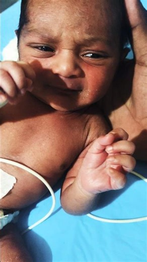 So #PrematureBaby #NewBornBaby#HungryBaby #TinyBaby #NICUBaby #NewbornCare #BabyCrying #BabyShorts