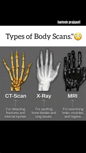 Three types of body scan