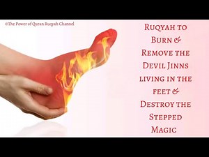 Ultimate Ruqyah to burn & remove Devil Jinns living in the legs & feet & Destroy the Stepped Magic