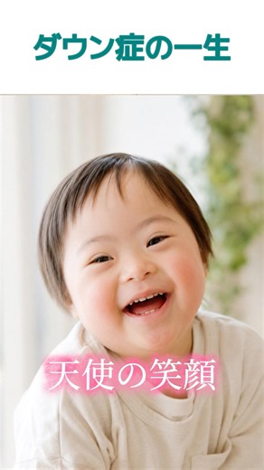 ダウン症の一生