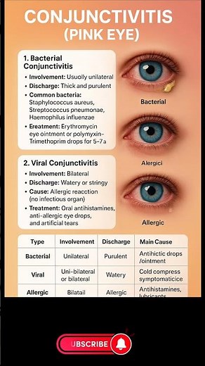 Viral Conjunctivitis (Pink Eye) – Symptoms, Causes & Quick Relief Tips | Prime Wellness