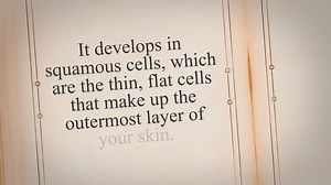 All you should know about Squamous Cell Cancer Ewacoltd