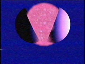 [READ DESCRIPTION] Central RARE ident (1982)