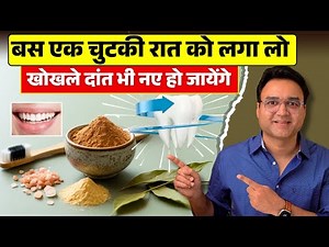 दाँतो की हर एक समस्या का समाधान | खोखले, पीले, कीड़ा लगे दाँतों से छुटकारा पाओ | DIY Tooth Powder