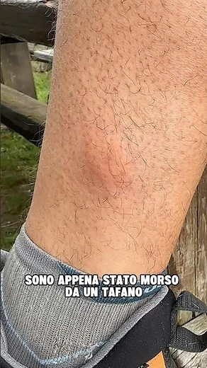HORSEFLY Bite, What to Do?