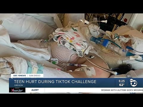 Teen hurt during TikTok fire challenge