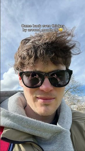 I used finasteride and minoxidil for 3 years…