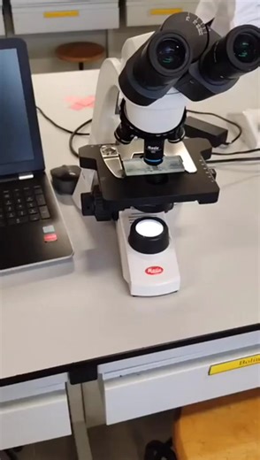 Urine microscopy 🤩 #lablife #diagnosis #microbiology | Lab life