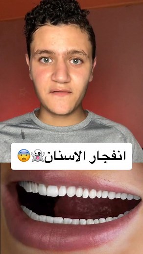 Exploding Teeth! 💥