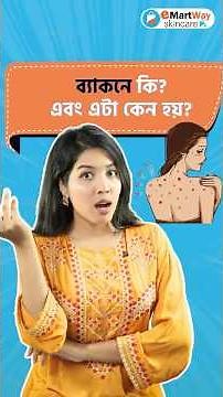 What is Backne? Causes and Easy Tips to Get Rid of Back Acne