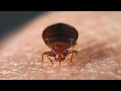 What Do Bed Bug Bites Look Like?