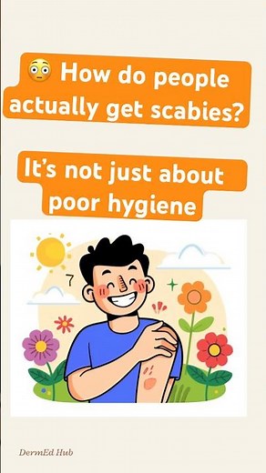 😳 How do people actually get scabies?It’s not just about poor hygiene. #scabies #scabiestreatment